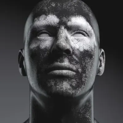 Xerxes