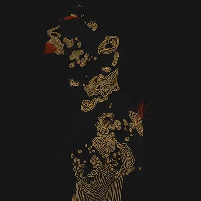 0.0.07 Vitiligo