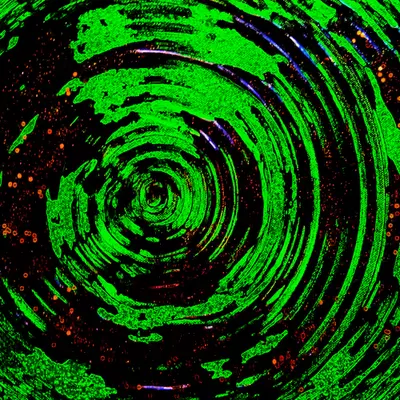 Black Hole Vortex