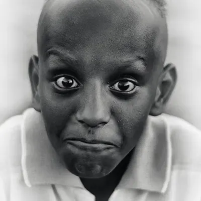 The eyes