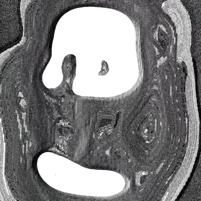 #49000087