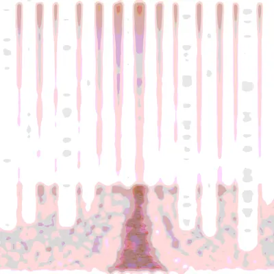 #2000158