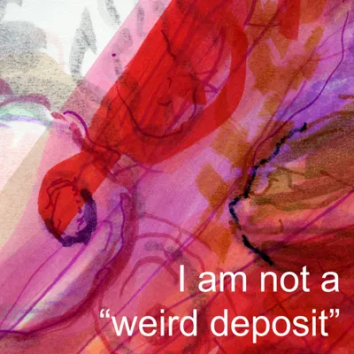 #26000085