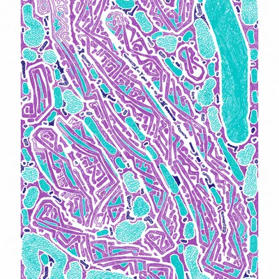 #1000171