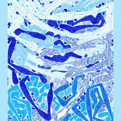 #1000174