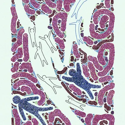 #2000162
