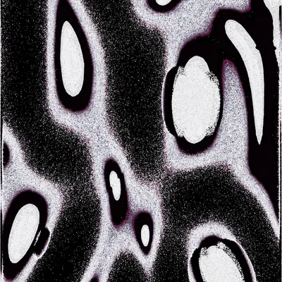 #2000062
