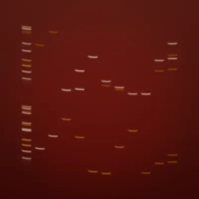 #322000158