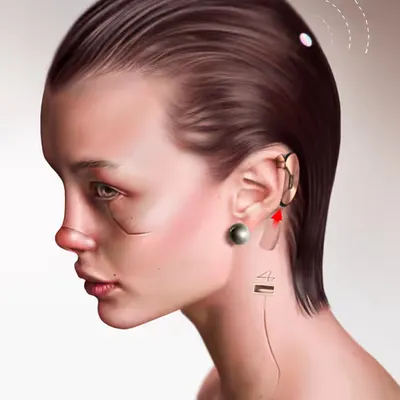 Neuralink