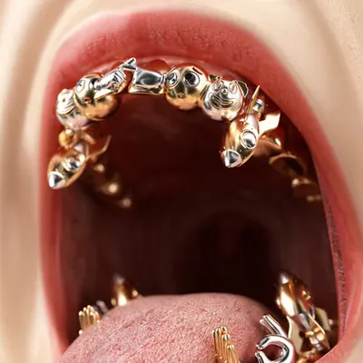 EMOJI GRILLZ
