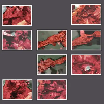 The Anatomy Lesson of Dr. Algorithm