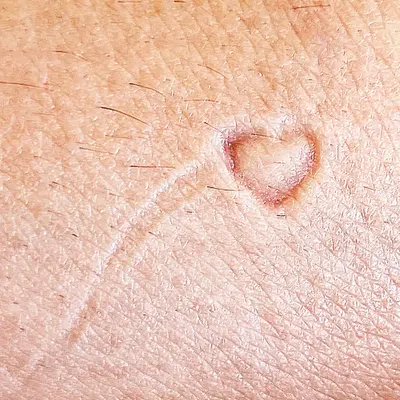 Heart Print