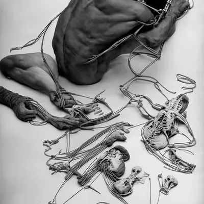 Installation