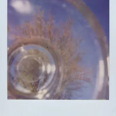 Eye