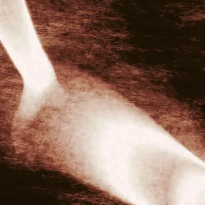 ultrasound wand