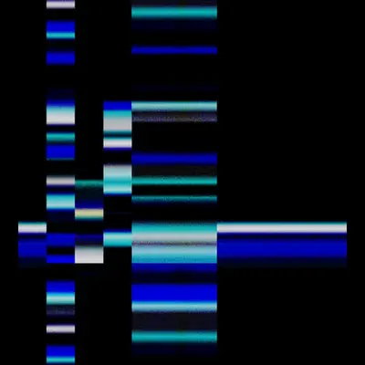 Echo, No Resonance #62