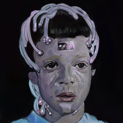 Child With Implants