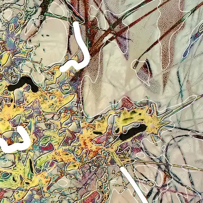 All In (detail of a bigger picture) 1