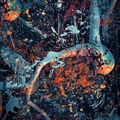 Antipatharia