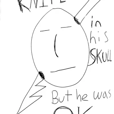 He Had A Knife In His Skull, But He Was OK