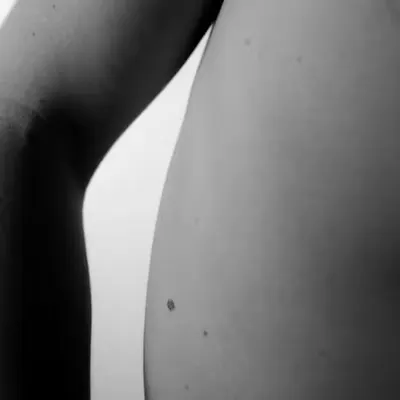 BDR #2