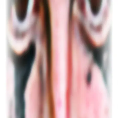 HA