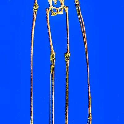 gibbon's skeleton