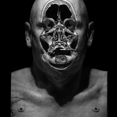 Anonymized 09