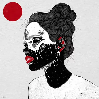 LUPUS