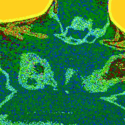 Torso (PHO00002 02292024)