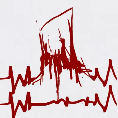damaged pulse rate