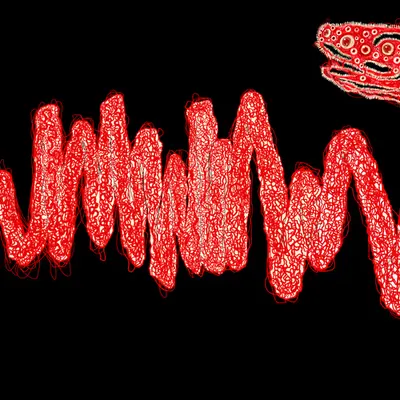 Chromie Tapeworm Micrograph <j>