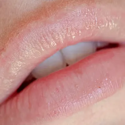 Soft Lips