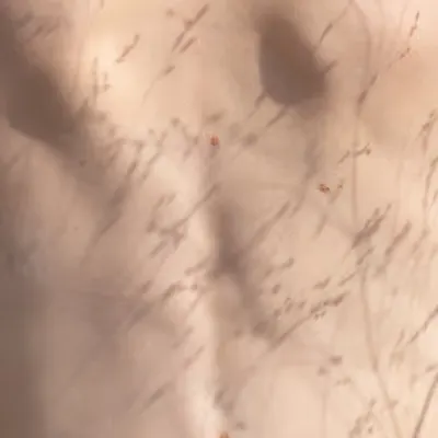 Summer Caresses