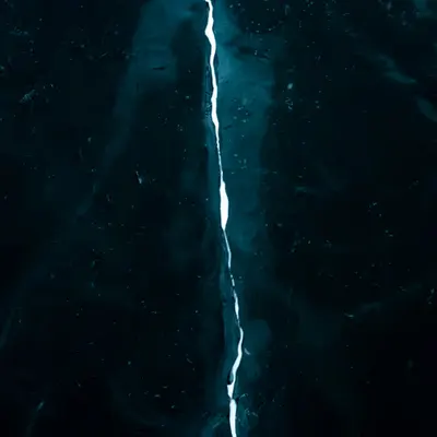 fracture
