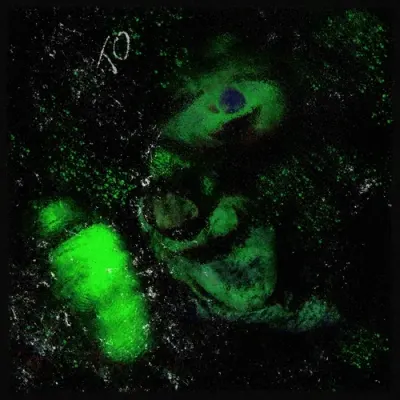 Lo[_]|]